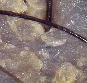 Struttura e chimica del cuoio capelluto - CAPELLI E CUOIO ...